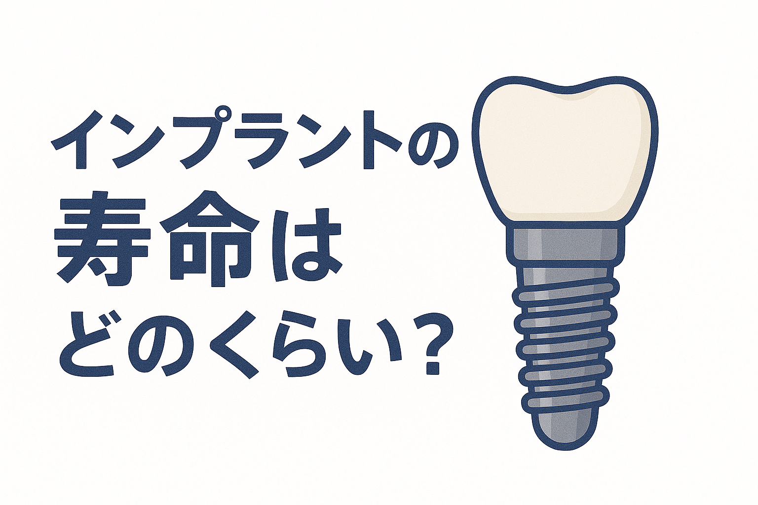 インプラントの寿命はどのくらい？有効なメンテナンスについても解説
