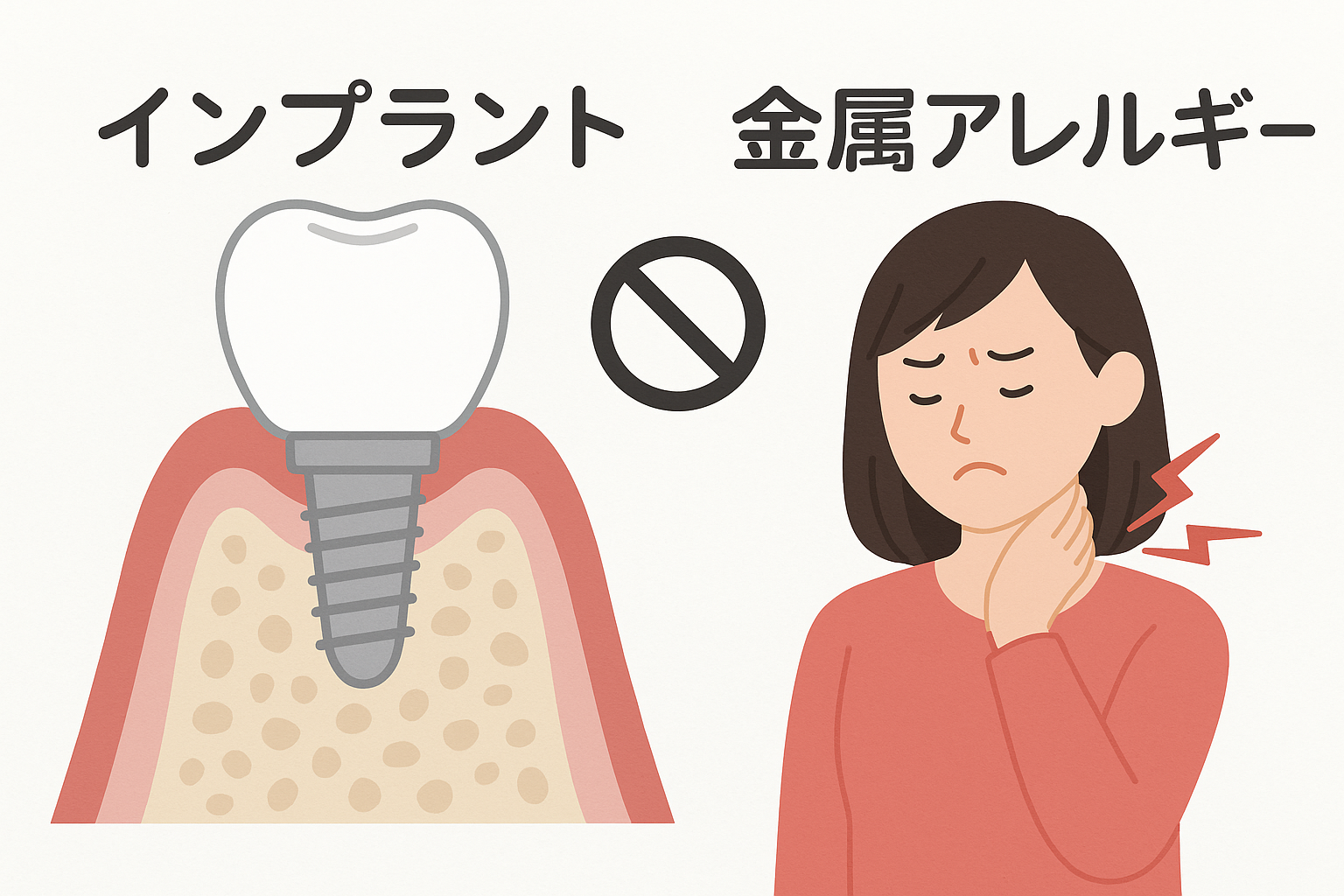 金属アレルギーの人がインプラント治療を受ける場合に注意すること